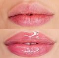 Hydra Lips